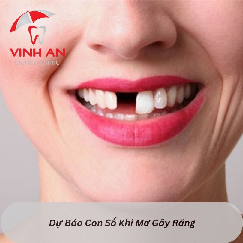 Ngủ mơ gãy răng đánh con gì? Gallery 1