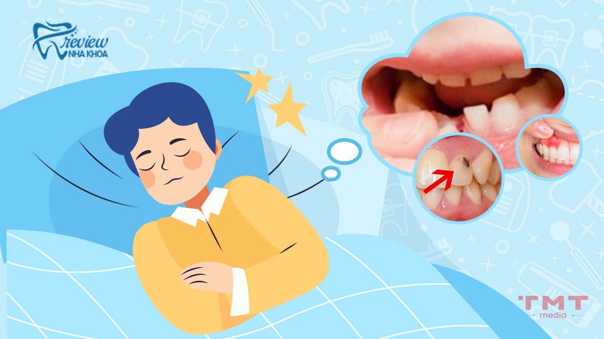 Nằm Mơ Răng Lung Lay Có Ý Nghĩa Gì? Giải Mã Giấc Mơ Chi Tiết Gallery 1
