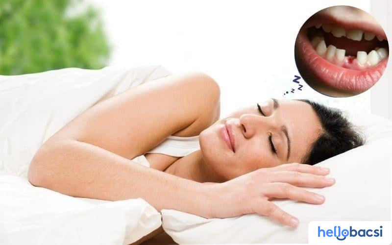 Mơ Bị Rụng Răng Chảy Máu: Điềm Báo Gì? Gallery 1