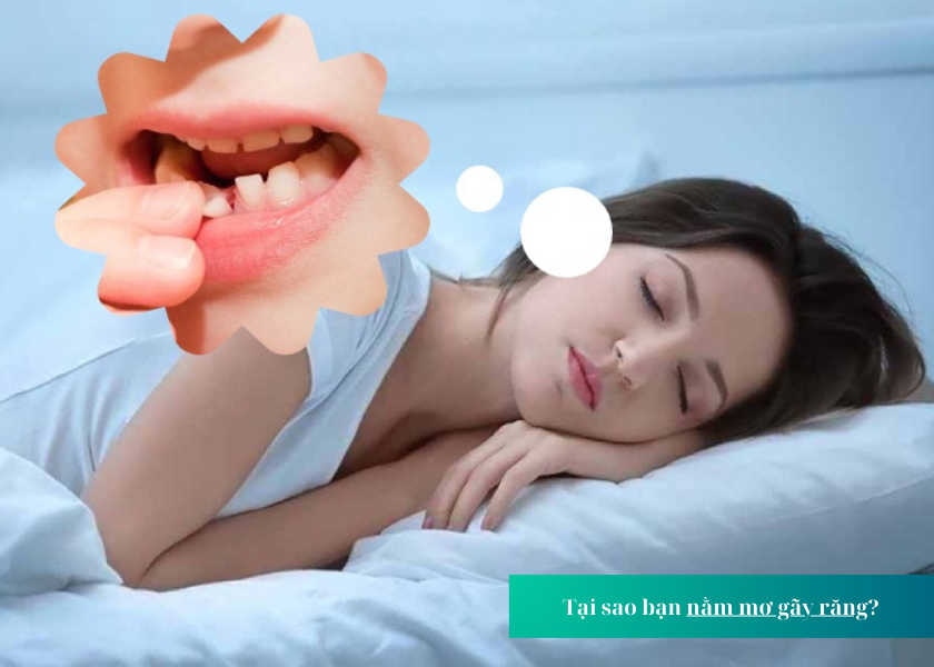 Mơ Bị Rụng Răng Hàm Dưới: Điềm Báo Gì? Giải Mã Giấc Mơ Chính Xác Gallery 1
