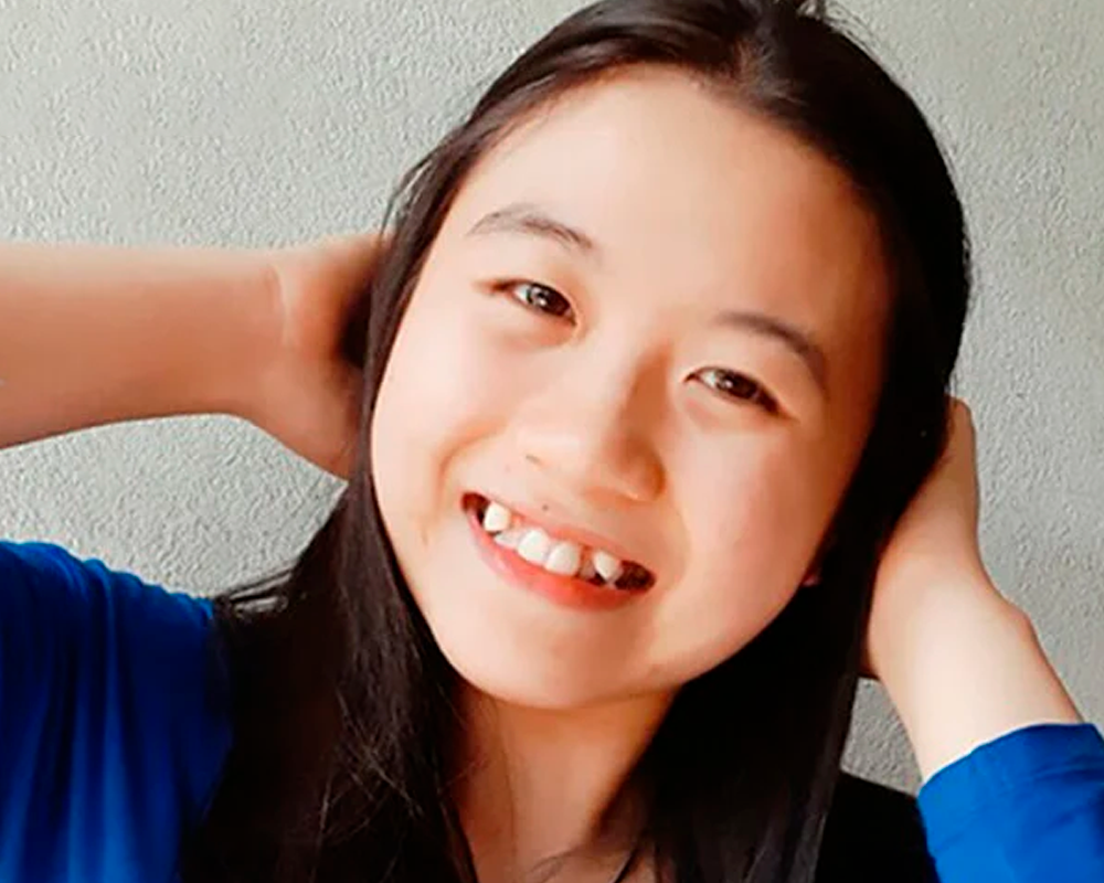 Con Gái Có Răng Khểnh: Vẻ Đẹp Ngọt Ngào Hay Khiếm Khuất? Gallery 2