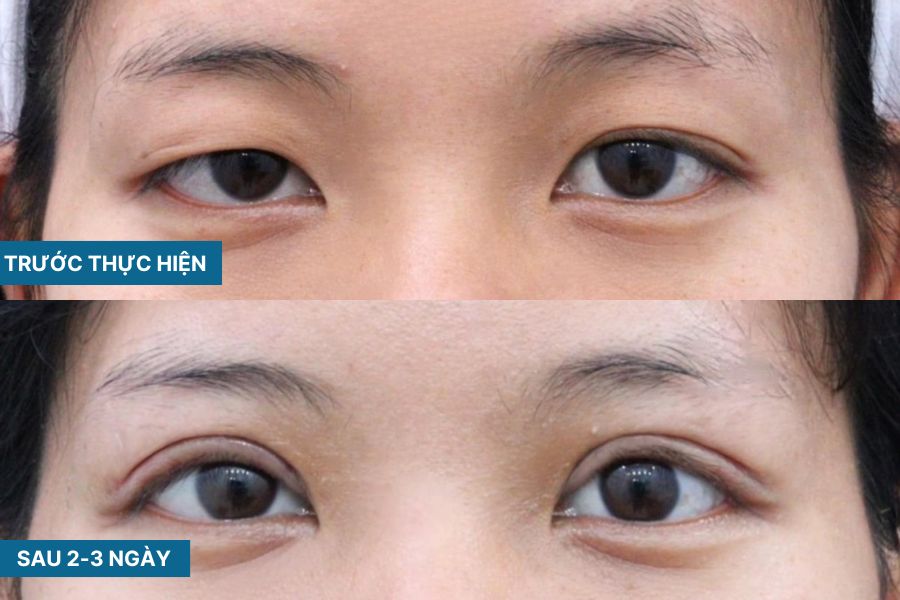 Giang Xảo: Công Dụng, Cách Sử Dụng Và Những Lưu Ý Quan Trọng