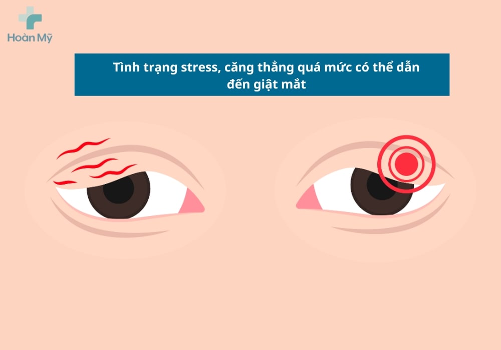Giật Mắt Phải: Điềm Báo Hay Ngẫu Nhiên?