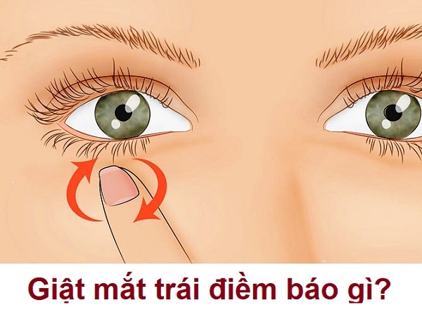 Giật Mắt Trái Nam Là Điềm Gì?