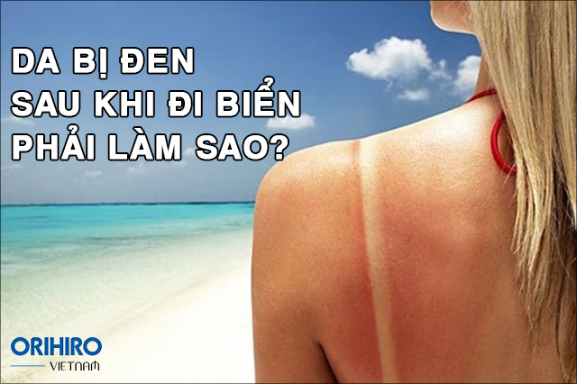 Gió biển có làm đen da không?