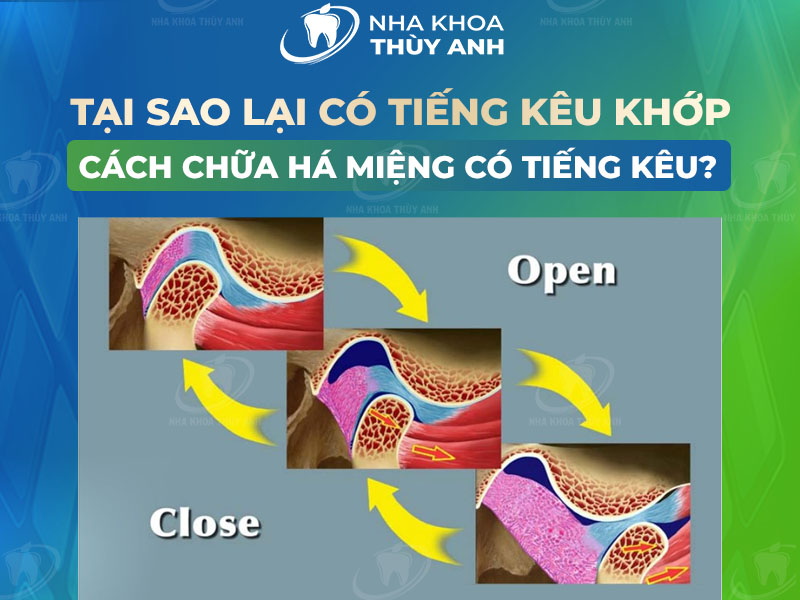 Há Miệng Có Tiếng Kêu 1 Bên: Nguyên Nhân và Cách Khắc Phục