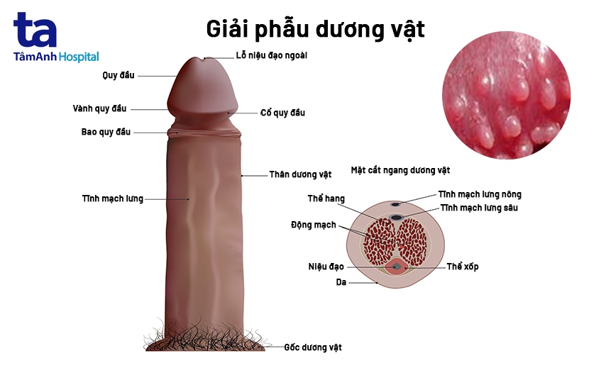 Hạt Cườm Dương Vật