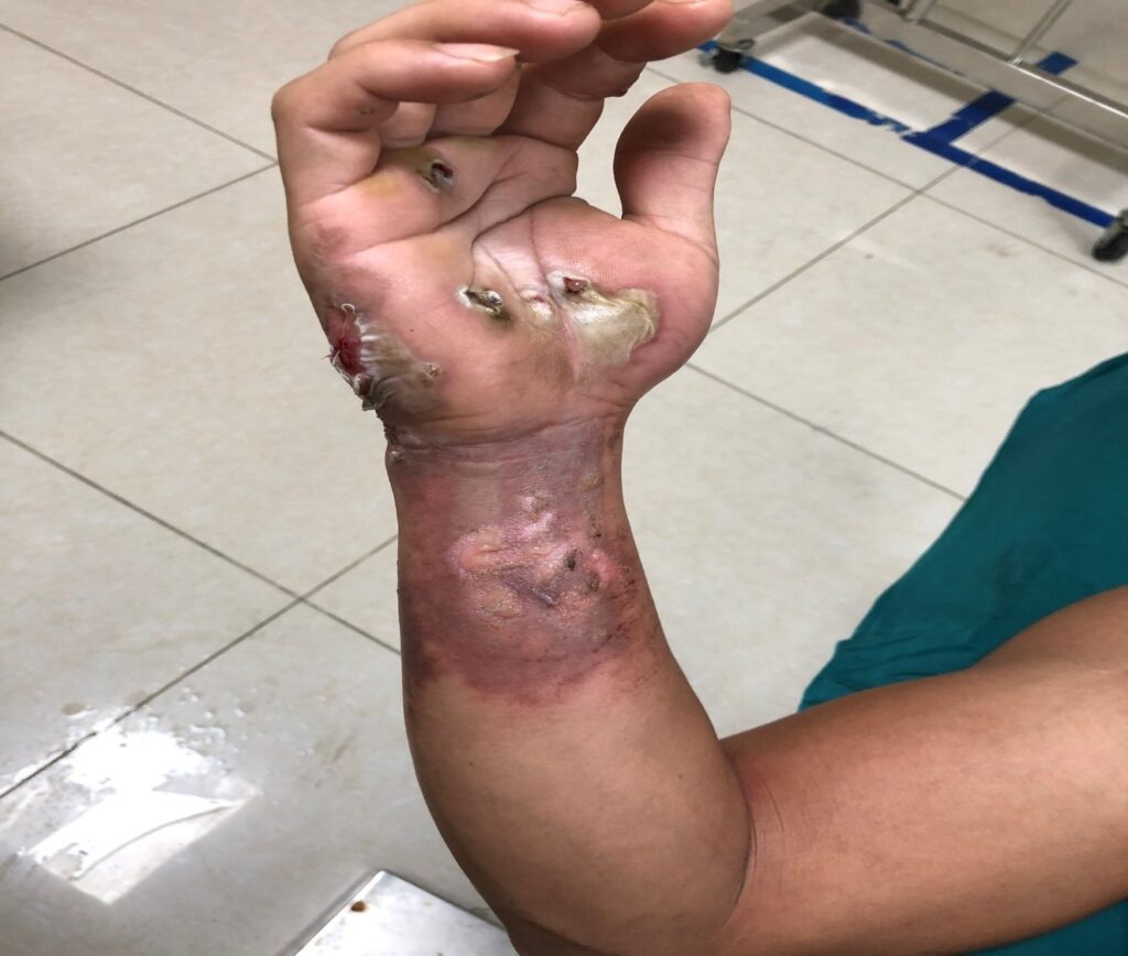 Sốc điện là gì? Gallery 2