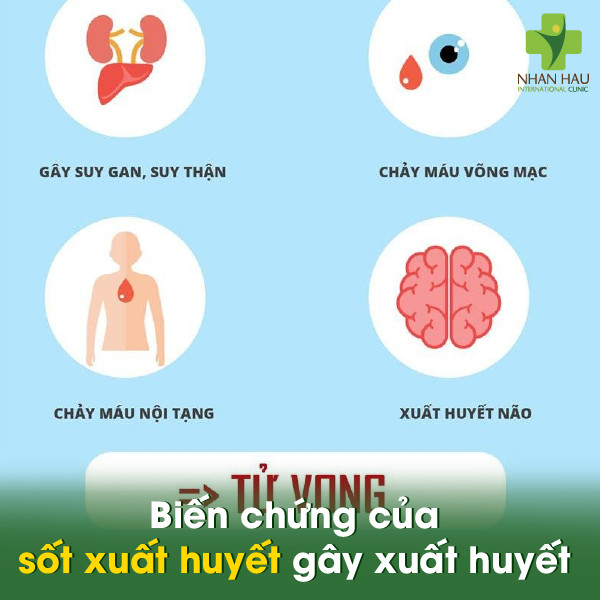 Đột Xuất Xảy Ra Là Gì? Nguyên Nhân, Hậu Quả và Cách Phản Ứng Gallery 2