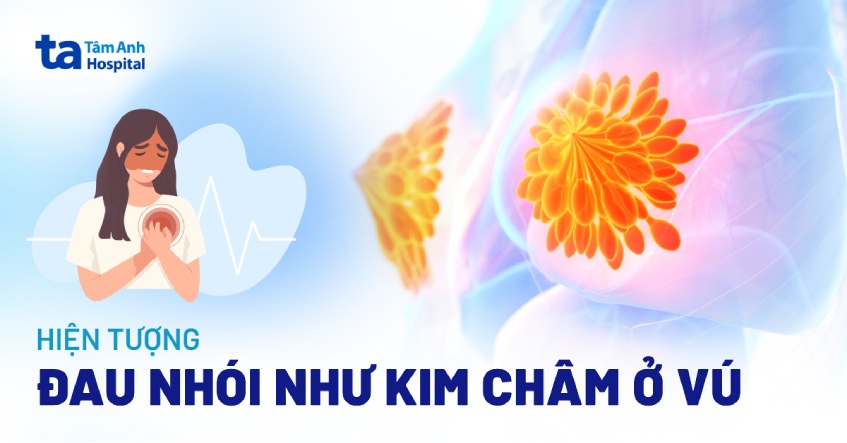 Đau Nhói Như Kim Châm Là Gì? Nguyên Nhân Và Cách Khắc Phục