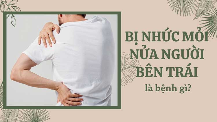 Đau Nhức Nửa Người Bên Trái: Nguyên Nhân và Cách Khắc Phục