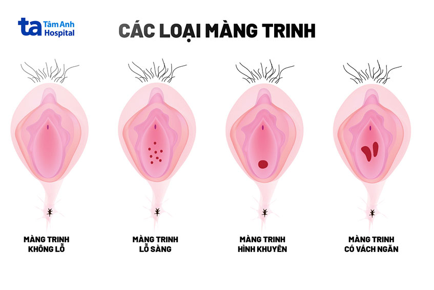 Cách Vứt Bỏ Trinh Tiết Lần 2 Gallery 1