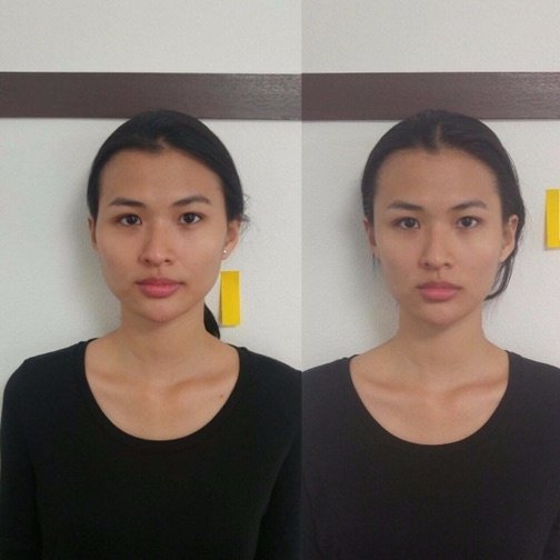 Nắn chỉnh khuôn mặt bằng tay Gallery 1