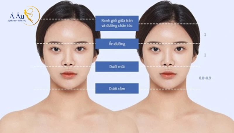 Phụ nữ trán cao và dô: Bí quyết làm đẹp và tự tin tỏa sáng Gallery 1