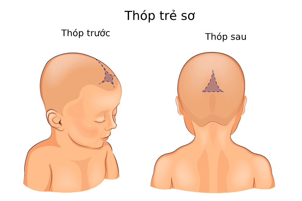 Đóng thóp sớm là gì? Gallery 1