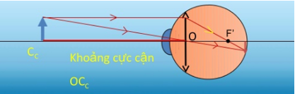 Khoảng cực cận là gì? Gallery 1