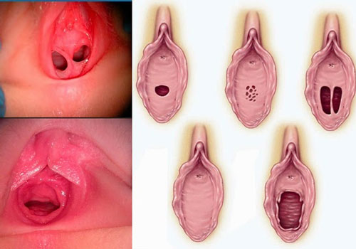 Quan hệ cọ xát bên ngoài có mất trinh không? Gallery 1