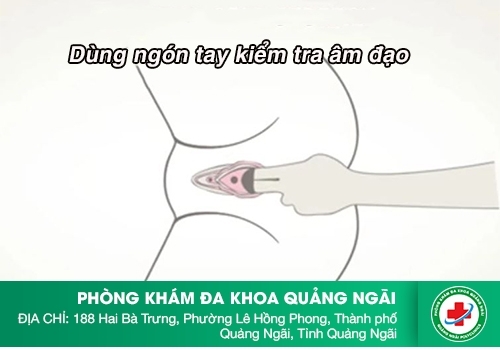 Thuốc Se Khít Âm Đạo: Bí Quyết Khôi Phục Vẻ Đẹp Vùng Kín Gallery 1