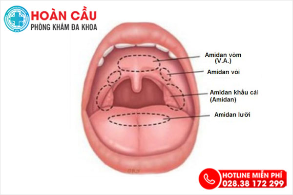 Sùi Vòm Họng Ở Người Lớn Gallery 1