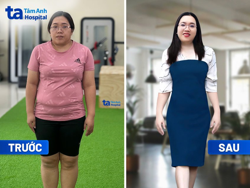 Sẽ Gầy Hình Ảnh Gallery 1
