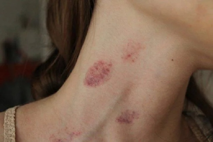 Hít Cổ: Lợi Ích, Kỹ Thuật Và Những Điều Cần Lưu Ý