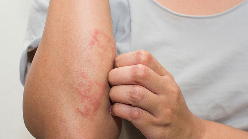 HIV Bao Lâu Thì Chết?