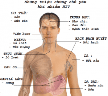 HIV Bao Lâu Thì Chết? Gallery 2