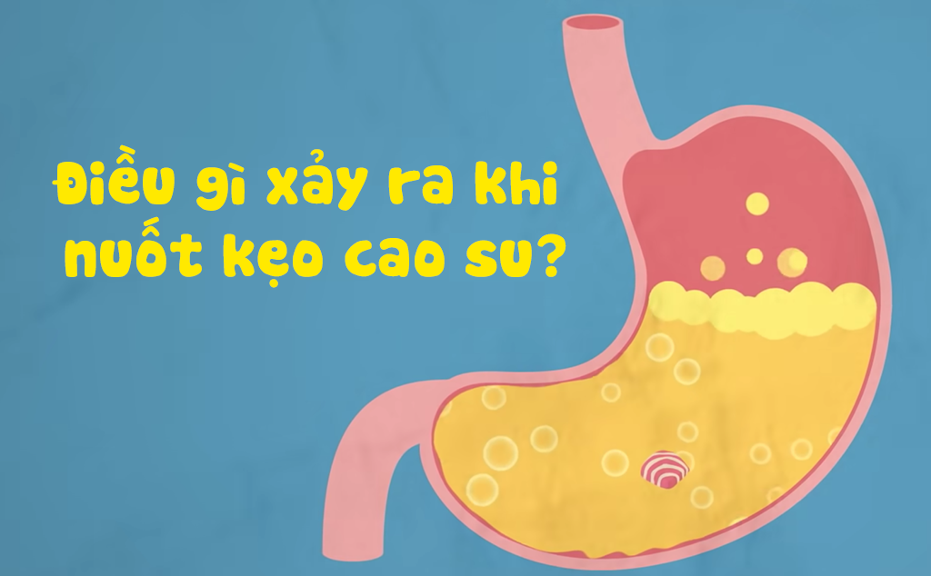 Nuốt kẹo cao su có sao không? Gallery 1