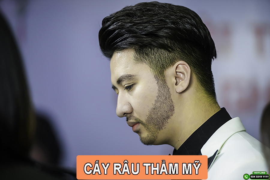 Rậm Râu Sâu Mắt: Bí Quyết Để Có Vẻ Nam Tính Quyến Rũ Gallery 2