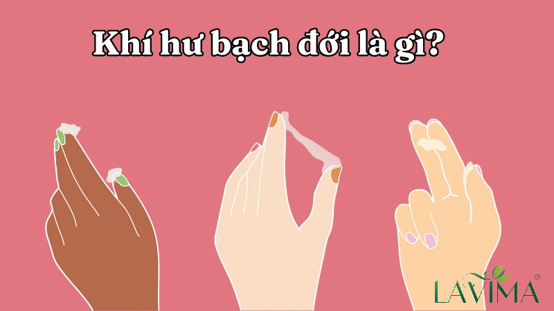 Khí hư bạch đới là gì?