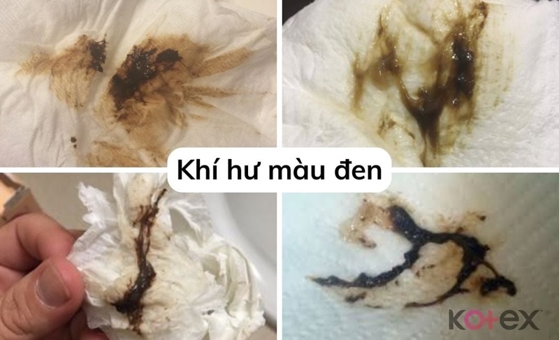 Khí hư có màu đen