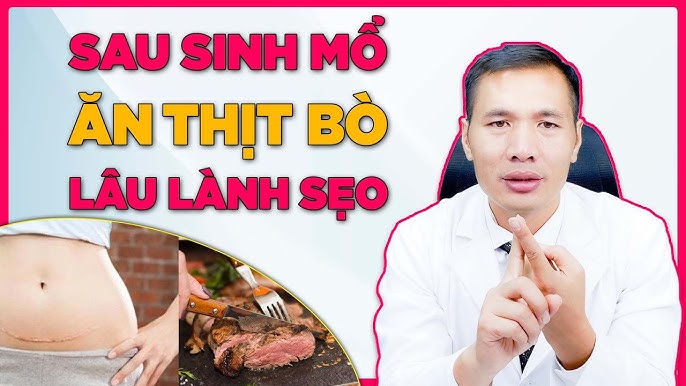Bà đẻ ăn thịt bò được không? Gallery 2
