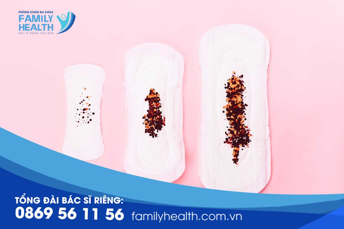 Kinh Nguyệt Màu Sẫm: Nguyên Nhân và Điều Trị Gallery 2