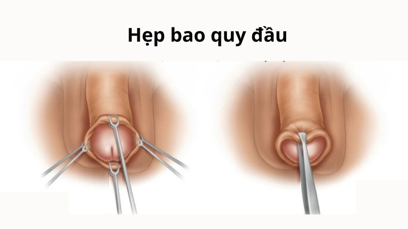 Kích thước bộ phận sinh dục bé trai 12 tuổi Gallery 2