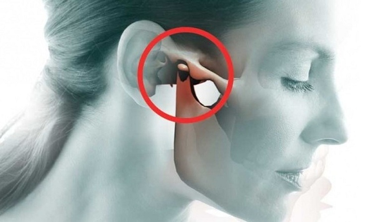 Nuốt Nước Bọt Nghe Tiếng Kêu Trong Tai: Nguyên Nhân Và Cách Khắc Phục Gallery 2