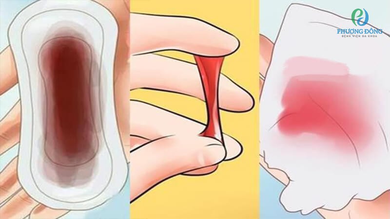 Chảy Máu Hồng Nhạt: Nguyên Nhân và Cách Xử Trí Gallery 2