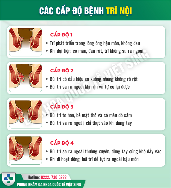 Biểu Hiện Trĩ Nội: Nhận Biết Và Điều Trị Kịp Thời Gallery 2