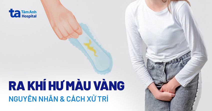 Khí hư màu vàng đặc dính: Nguyên nhân và cách xử lý Gallery 2