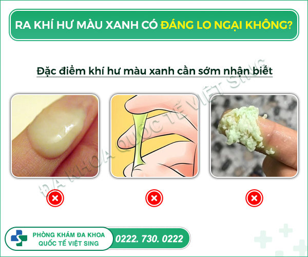 Khí hư màu xanh nhạt không mùi không ngứa: Nguyên nhân và cách xử trí Gallery 2