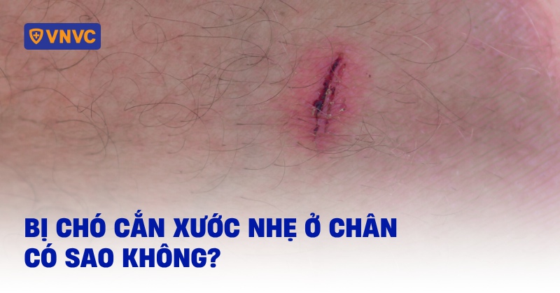Làm gì khi bị chó cắn nhẹ không chảy máu? Gallery 2