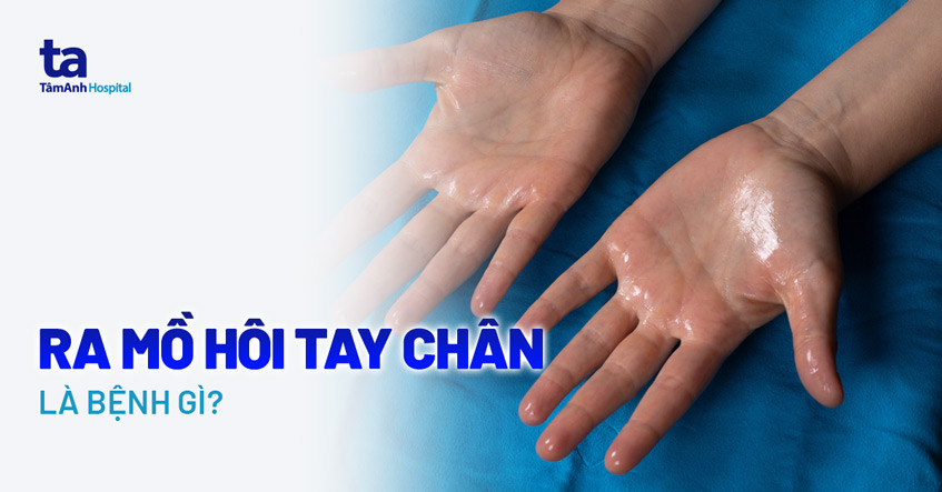 Tay Chân Ra Mồ Hôi Lạnh Là Bệnh Gì? Gallery 2