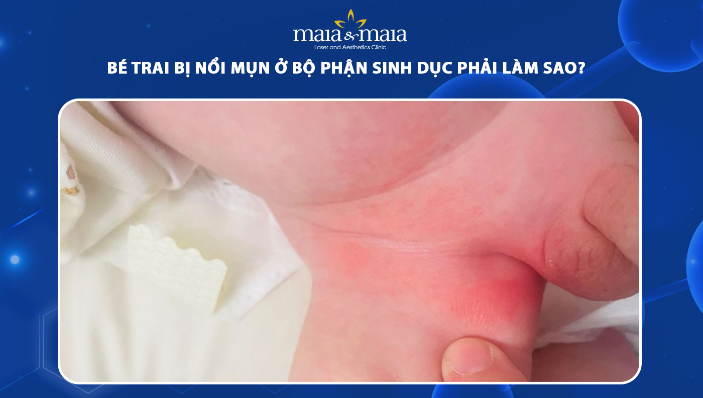 Bé Trai Bị Nổi Mụn Ở Bộ Phận Sinh Dục Gallery 2
