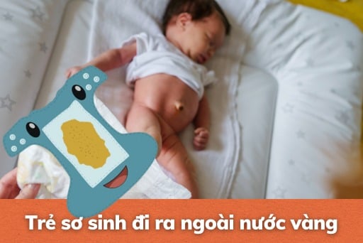 Trẻ xì hơi ra nước màu vàng: Nguyên nhân và cách xử lý Gallery 2