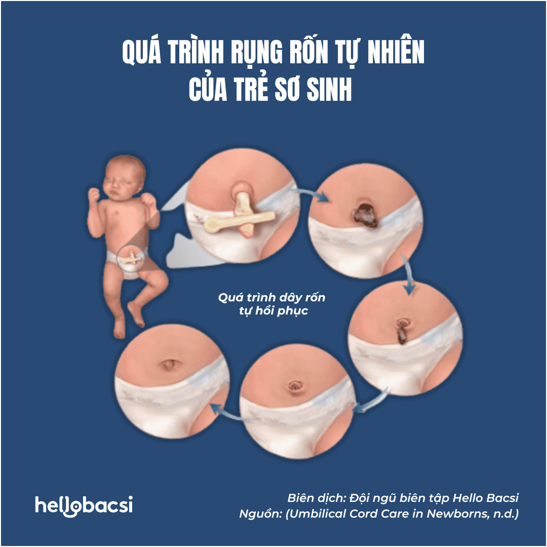 Rốn rụng để đâu? Gallery 2
