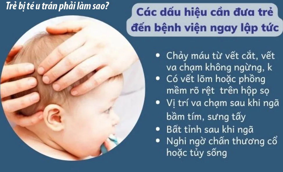 Vì sao trẻ bị trán dô? Gallery 2