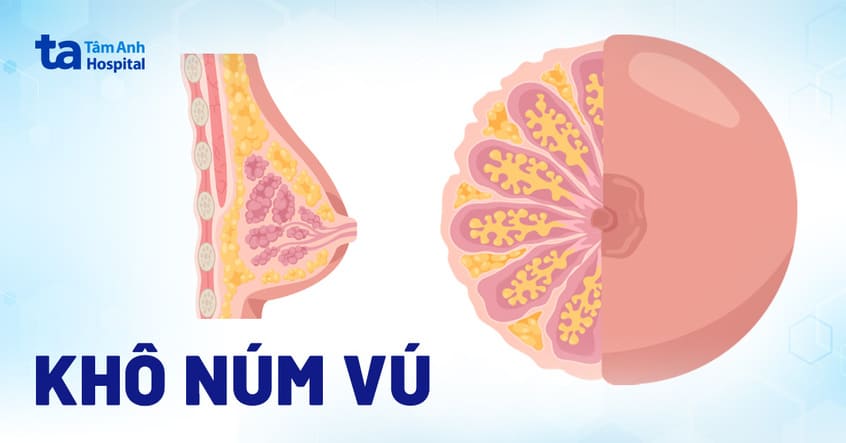 Cách Chữa Nứt Đầu Ti Gallery 2