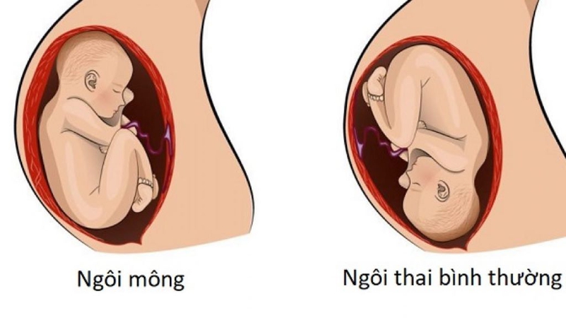 Em Bé Quay Đầu Mẹ Có Bị Đau Bụng Không? Gallery 2