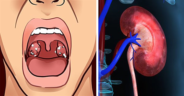 Nước Bọt Có Vị Mặn: Nguyên Nhân Và Cách Khắc Phục Gallery 2