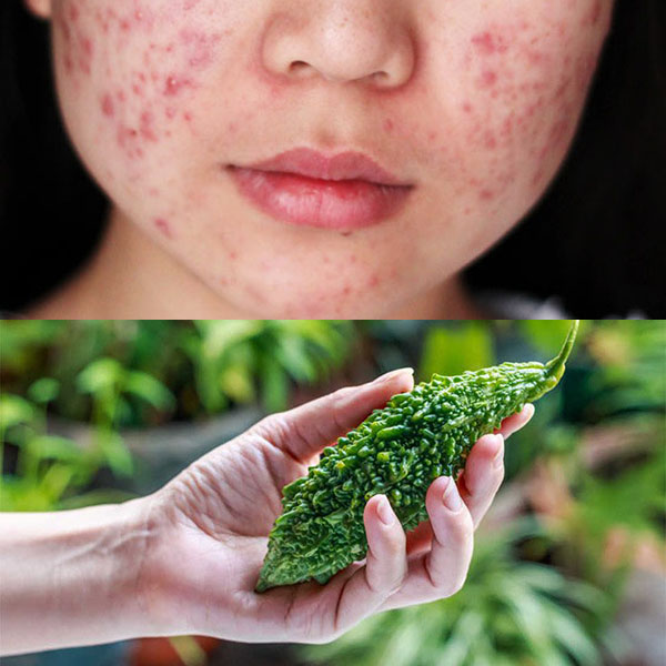 Trồi lên hay trồi lên? Gallery 1