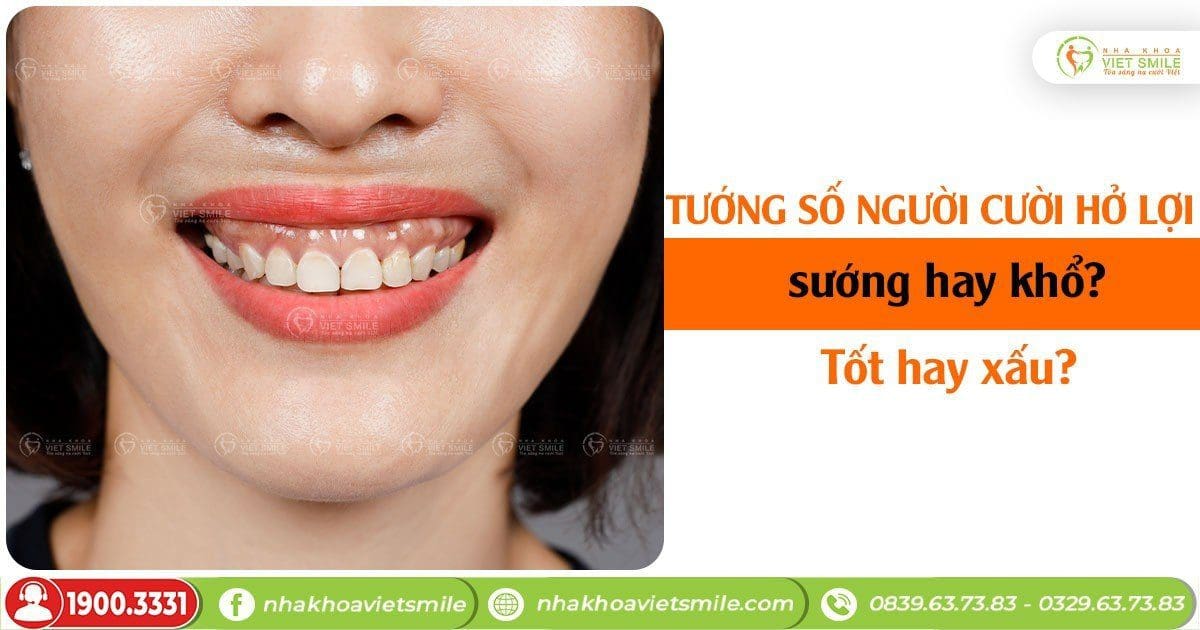 Phụ nữ cười hở lợi tốt hay xấu? Gallery 2